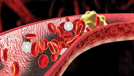 The “good” and the “bad” Cholesterol